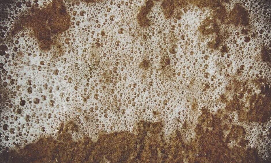 Bubbly Faecal Pattern May Predict Neonatal Intestinal Pneumatosis – EMJ
