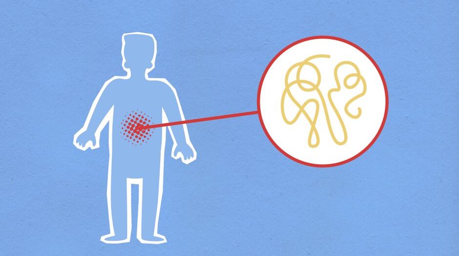 Study Links Menopause to Gut Damage and Inflammation Risks – India News Network