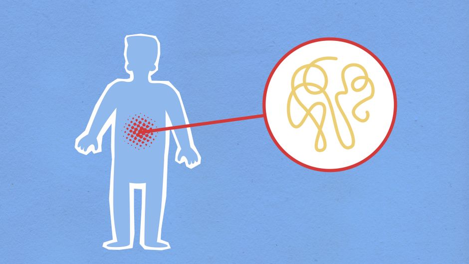 Study Links Menopause to Gut Damage and Inflammation Risks – India News Network